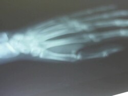 X-ray film Stock Footage