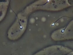 Human sperm swimming, close up, Phase contrast Stock Footage