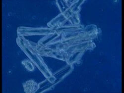 Microscopic view of heart muscle contracting Stock Footage