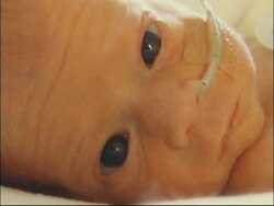 Platelet and blood donations are vital to the survival of premature babies ++EMBARGOED++ News Clip