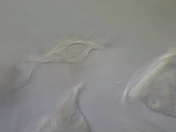 Vorticella sp. filter feeding: inverted bell-shaped ciliates, placed among the peritrichs. Each cell has a separate stalk anchored onto the substrate, which contains a contractile fibril called a myoneme. Stock Footage