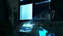 Operating room. Balloon Angioplasty Stock Footage