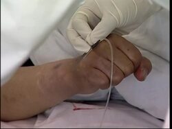 Exercise regime to help heroin abusers beat addiction Instructional Video