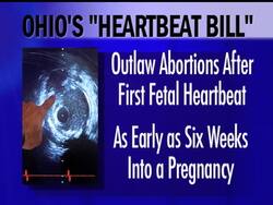 State lawmakers in Ohio have seen ultrasound images of two fetuses as proponents of what would be the most stringent abortion law in the nation pushed their proposal.  The bill would ban abortions after the first heartbeat can be medically detected. News Clip