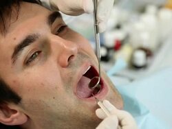 Young man at the dentist Stock Footage