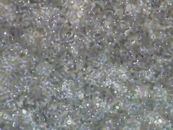 Human sperm, masses swimming around, wide pan Stock Footage