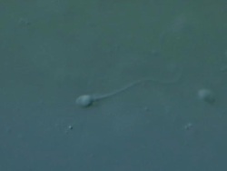 Single Human sperm swimming, Interference contrast Stock Footage