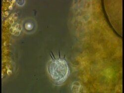 Ciliate protozoan Stock Footage