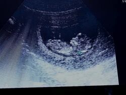 Ultrasound Stock Footage