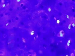 Blue Defocused Particles Stock Footage