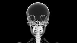 Loopable X-ray skull Stock Footage