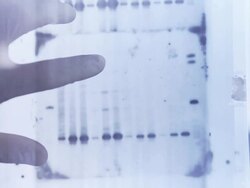 DNA genetic analysis results Stock Footage