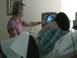 Ultrasound Exam Stock Footage