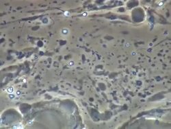 Human sperm swept along in ejaculate Stock Footage