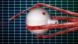 An EKG blips behind a 3D representation of an eye. Stock Footage