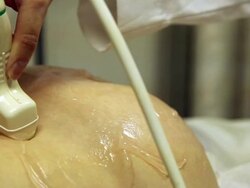 Pregnant woman doing ultrasound Stock Footage