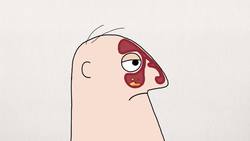 TED-ED: What causes headaches? - Dan Kwartler Instructional Video