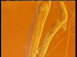 CU microscopic view of Arthrobotrys Fungi trapping Nematode roundworm, moves through and is trapped by loop Stock Footage