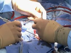 CU  Doctors doing childs heart surgery /  Little Rock, Arkansas, USA Stock Footage