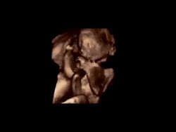 Foetus in the womb, rotating 3D ultrasound scan.. Stock Footage