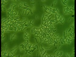 T/L Microscopic view of bacteria Stock Footage