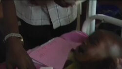 Doctor''s joy as baby boy recovers from brink of starvation Instructional Video