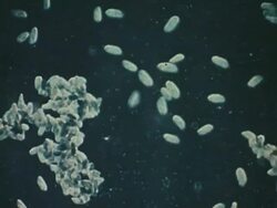 Paramecia under microscope Stock Footage