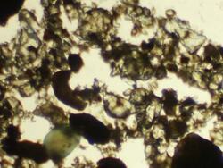 Micro organism: Stentor coeruleus Stock Footage