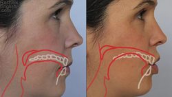 How to Make the BR Consonant Cluster Instructional Video