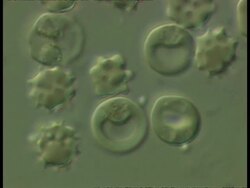 Exflagellation caused by Plasmodium berghei, the malarial parasite, in mouse blood cells Stock Footage