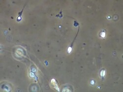 Single Human sperm swimming, wow shot, Phase contrast Stock Footage