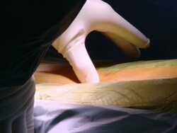  CU Surgeon hands on area to be operated / Cagliari, Sardinia, Italy Stock Footage