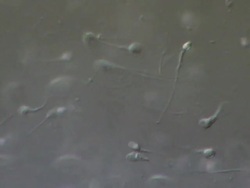 Human sperm swimming with track, includes two tailed Human sperm, Interference contrast Stock Footage