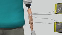 Amputees gets first bionic hand able to feel Instructional Video