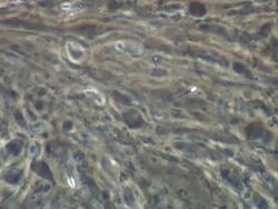 Human sperm, single sperm swimming with difficulty Stock Footage