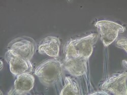 Vorticella sp. are often found in clusters, each stalk is individually attached to the surface. The stalk is made up of an external sheath that contains a fluid and a spirally arranged contractile fibril called a myoneme that contracts when stimulated. Stock Footage