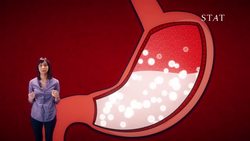 Boddities | Episode 1 | Will soda settle your upset stomach? Instructional Video