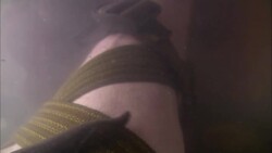 A leech moves over a man's submerged leg that is wrapped in webbing. Stock Footage