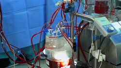 Doctor writes down Cardiopulmonary bypass machine data Stock Footage