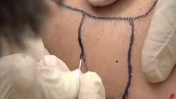 DIY Tattoos Call for Tighter Regulations News Clip