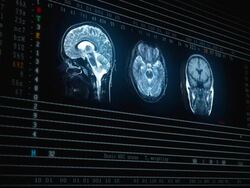 Brain MRT scan Stock Footage