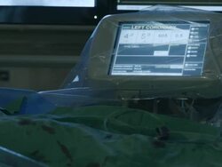 Vascular surgery. Stock Footage