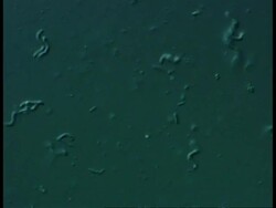 Spirochaete bacteria Stock Footage