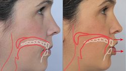 English: How to Pronounce CH [_] and JJ [_] Sounds: American Accent Instructional Video