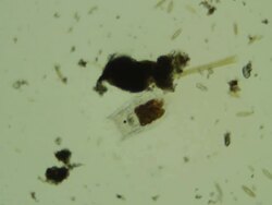 Microbe in dirty water Stock Footage