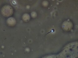 Human sperm swimming, close up, Phase contrast Stock Footage