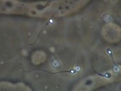 Human sperm swimming, close up, Phase contrast Stock Footage