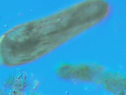 Ciliate unidentified Stock Footage