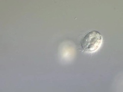 Urotricha sp. imaged using Differential Interference Contrast Stock Footage