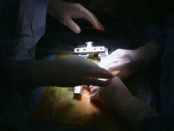 MS ZI ZO TU TD PAN Surgeon operating on spine / Cagliari, Sardinia, Italy Stock Footage